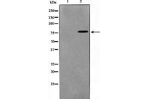 Western blot analysis on HuvEc cell lysate using TGM2 Antibody,The lane on the left is treated with the antigen-specific peptide.