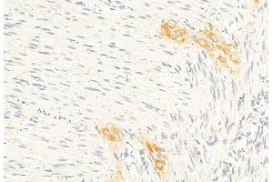 ABIN6261371 and ABIN6277296 at 1/100 staining Rat stomach tissue by IHC-P. (Dynamin 1-Like anticorps  (C-Term))