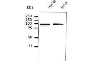 Anti-Calnexin ER membrane marker Ab (ABOC37) at 1/500 dilution, lysates at 50 µg per Iane, Rabbit potyctonal to goat lµg (HRP) at 1/10,000 dilution, (Calnexin anticorps  (C-Term))