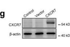 The SDF-1/CXCR7 axis promotes vasculogenesis by MSCs.
