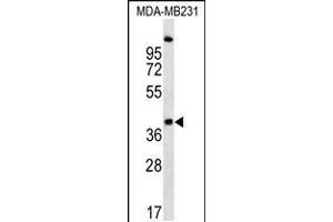 Western blot analysis in MDA-MB231 cell line lysates (35ug/lane).