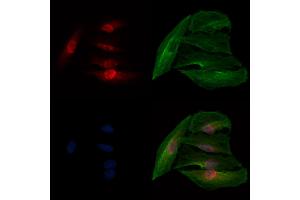 ABIN7093928 and ABIN7097972 staining  cells by IF/ICC. (NHP2 anticorps  (Internal Region))