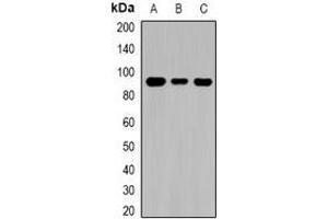 Western blot analysis of TGase1 expression in MCF7 (A), mouse kidney (B), rat brain (C) whole cell lysates. (TGM1 anticorps)
