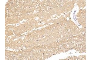 Detection of TUBb in Human Cerebrum Tissue using Polyclonal Antibody to Tubulin Beta (TUBb)