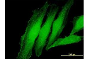 Immunofluorescence of purified MaxPab antibody to EXOSC1 on HeLa cell.