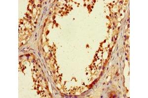 Immunohistochemistry of paraffin-embedded human testis tissue using ABIN7176179 at dilution of 1:100 (ZNF23 anticorps  (AA 201-474))
