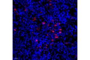 Immunofluorescence of paraffin embedded mouse spleen using BIRC3 (ABIN7073179) at dilution of 1: 1000 (400x lens)