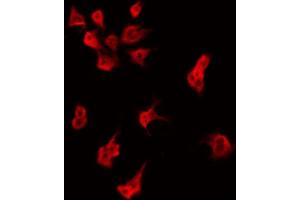 ABIN6274848 staining HeLa by IF/ICC. (AIG1 anticorps  (C-Term))