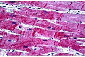 Human Heart: Formalin-Fixed, Paraffin-Embedded (FFPE) (HSPB8 anticorps  (AA 97-197))