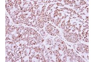 anti-Interferon Regulatory Factor 9 (IRF9) (AA 171-393) antibody