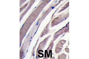 Formalin-fixed and paraffin-embedded human skeletal muscle tissue reacted with HK2 polyclonal antibody  , which was peroxidase-conjugated to the secondary antibody, followed by DAB staining. (Hexokinase 2 anticorps  (N-Term))