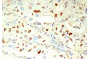 Immunohistochemistry (IHC) image for anti-Cyclin E1 (CCNE1) antibody (ABIN567783)
