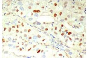 Immunohistochemistry (IHC) image for anti-Cyclin E1 (CCNE1) antibody (ABIN567783) (Cyclin E1 anticorps)