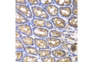 Immunohistochemistry of paraffin-embedded mouse Intestine using BMPR1B antibody (ABIN5971046) at dilution of 1/200 (40x lens). (BMPR1B anticorps)