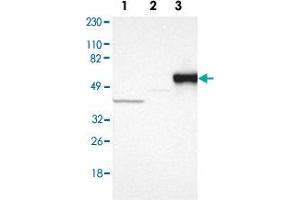 Western blot anyalysis of Lane 1: Human cell line RT-4, Lane 2: Human cell line U-251MG sp, Lane 3: Human plasma (IgG/HSA depleted) with SERPINA7 polyclonal antibody . (SERPINA7 anticorps)