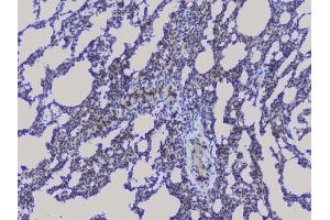 IHC analysis of NRF1 using anti-NRF1 antibody (ABIN6719347).
