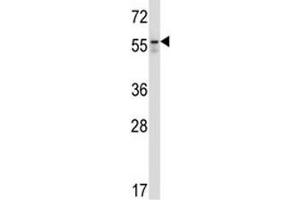 BECN antibody western blot analysis in Jurkat lysate
