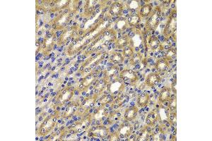 Immunohistochemistry of paraffin-embedded mouse kidney using CCNA2 antibody at dilution of 1:100 (x400 lens). (Cyclin A anticorps)