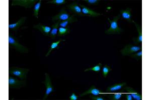 Immunofluorescence of purified MaxPab antibody to RAPGEF3 on HeLa cell. (RAPGEF3 anticorps  (AA 1-881))