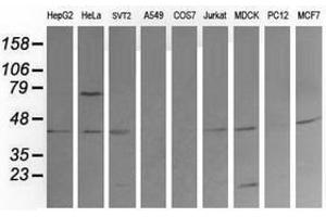 Image no. 6 for anti-Mitogen-Activated Protein Kinase Kinase 1 (MAP2K1) antibody (ABIN1499391) (MEK1 anticorps)