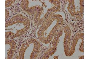 anti-Tachykinin, Precursor 1 (TAC1) (AA 20-129) antibody