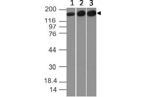 Image no. 1 for anti-Topoisomerase (DNA) II alpha 170kDa (TOP2A) (AA 1326-1512) antibody (ABIN5027278)