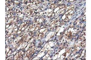 Image no. 1 for anti-Tubulin, alpha-Like 3 (TUBAL3) (AA 150-446) antibody (ABIN1490956)