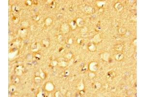 anti-Mannosidase, beta A, Lysosomal-Like (MANBAL) (AA 45-85) antibody