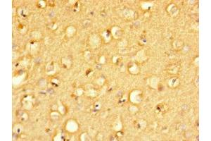 Immunohistochemistry of paraffin-embedded human brain tissue using ABIN7165793 at dilution of 1:100 (MANBAL anticorps  (AA 45-85))