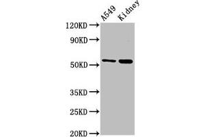 Western Blot Positive WB detected in: A549 whole cell lysate, Rat kidney tissue All lanes: AFG1L antibody at 3 μg/mL Secondary Goat polyclonal to rabbit IgG at 1/50000 dilution Predicted band size: 55 kDa Observed band size: 55 kDa (AFG1-Like ATPase (AFG1L) (AA 14-313) anticorps)