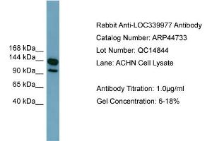 WB Suggested Anti-LRRC66  Antibody Titration: 0. (LRRC66 anticorps  (Middle Region))