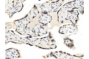 IHC analysis of JUNB using anti-JUNB antibody (ABIN7603223). (JunB anticorps  (N-Term))
