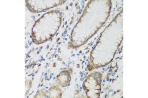 Immunohistochemistry of paraffin-embedded human gastric using SHBG antibody at dilution of 1:200 (40x lens).