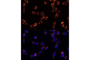 Immunofluorescence analysis of NIH/3T3 cells using TR antibody (ABIN1683134, ABIN5664756, ABIN5664758 and ABIN6220605) at dilution of 1:100.