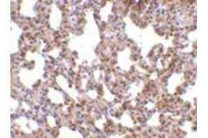 Immunohistochemistry of TRPC6 in mouse lung tissue with this product at 10 μg/ml. (TRPC6 anticorps  (C-Term))