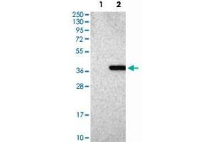 Western Blot analysis of Lane 1: negative control (vector only transfected HEK293T cell lysate) and Lane 2: over-expression lysate (co-expressed with a C-terminal myc-DDK tag in mammalian HEK293T cells) with MED4 polyclonal antibody . (MED4 anticorps)