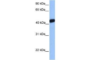 WB Suggested Anti-LMX1A Antibody   Titration: 1 ug/ml   Positive Control: 721_B Whole Cell