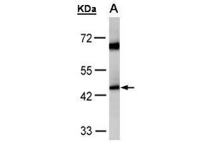 WB Image Sample(30 μg of whole cell lysate) A:HeLa S3, 10% SDS PAGE antibody diluted at 1:1000 (Medium-Chain Specific Acyl-CoA Dehydrogenase, Mitochondrial (C-Term) anticorps)