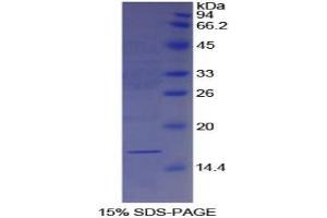 SDS-PAGE analysis of Human Galectin 7 Protein. (LGALS7 Protéine)