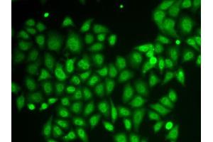 Immunofluorescence analysis of HeLa cells using AKR1A1 antibody. (AKR1A1 anticorps  (AA 1-325))