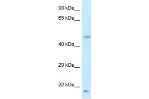 WB Suggested Anti-LOC100360413 Antibody   Titration: 1. (LOC100360413 anticorps  (Middle Region))