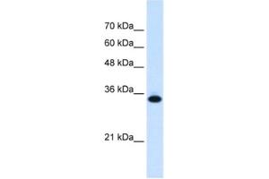 Western Blotting (WB) image for anti-Solute Carrier Family 25, Member 38 (SLC25A38) antibody (ABIN2462759) (SLC25A38 anticorps)