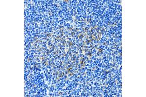 Immunohistochemistry of paraffin-embedded rat spleen using PAICS antibody. (PAICS anticorps)