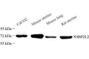 Western blot analysis of N4BP2L2 (ABIN7074791) at dilution of 1: 1000 (N4BP2L2 anticorps)