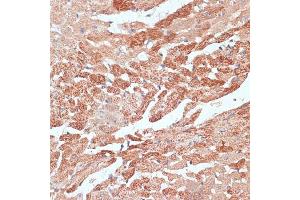 Immunohistochemistry of paraffin-embedded mouse heart using TMX1 antibody  at dilution of 1:100 (40x lens). (TMX1 anticorps  (AA 210-280))