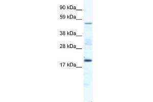 WB Suggested Anti-CSNK1G1 Antibody Titration:  5. (CSNK1G1 anticorps  (Middle Region))