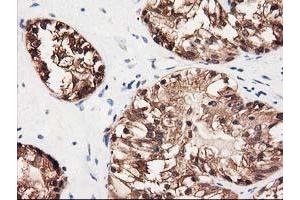 Image no. 2 for anti-UDP-Galactose-4-Epimerase (GALE) antibody (ABIN1498366) (GALE anticorps)