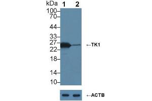 Knockout Varification: ;Lane 1: Wild-type MCF7 cell lysate; ;Lane 2: TK1 knockout MCF7 cell lysate; ;Predicted MW: 25kDa ;Observed MW: 25kDa;Primary Ab: 6µg/ml Mouse Anti-Human TK1 Antibody;Second Ab: 0. (TK1 anticorps  (AA 2-234))