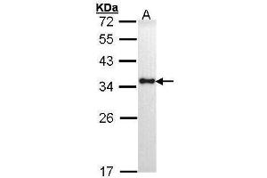 WB Image Sample (30 ug of whole cell lysate) A: H1299 12% SDS PAGE antibody diluted at 1:1000 (HLA-DRA anticorps)