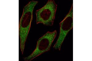 Immunofluorescence (IF) image for anti-Insulin Receptor Substrate 2 (IRS2) antibody (ABIN3003492)